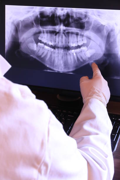 Best Urgent Care for Lost Fillings or Crowns in East Alton, IL